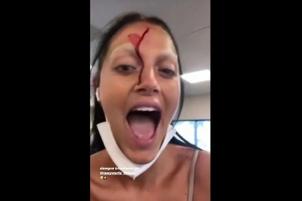 Video: Oriana Sabatini mostró el golpe que sufrió en el gimnasio