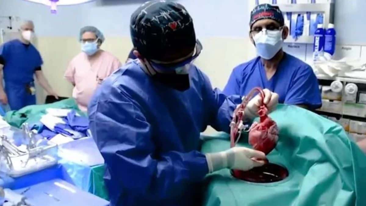 El corazón de cerdo trasplantado al hombre que luego murió estaba infectado de un virus porcino