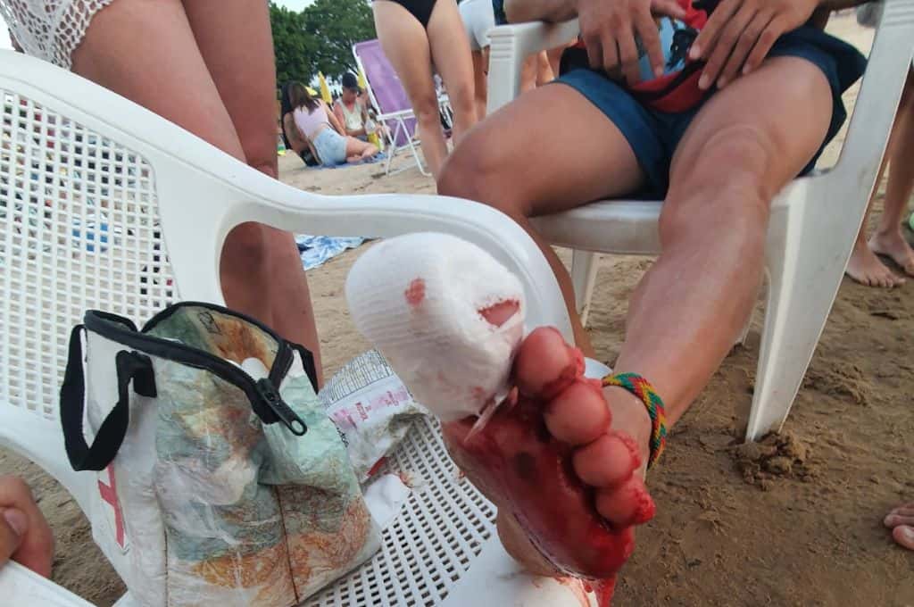 Alerta por palometas en la laguna Setúbal: suman 11 las personas heridas