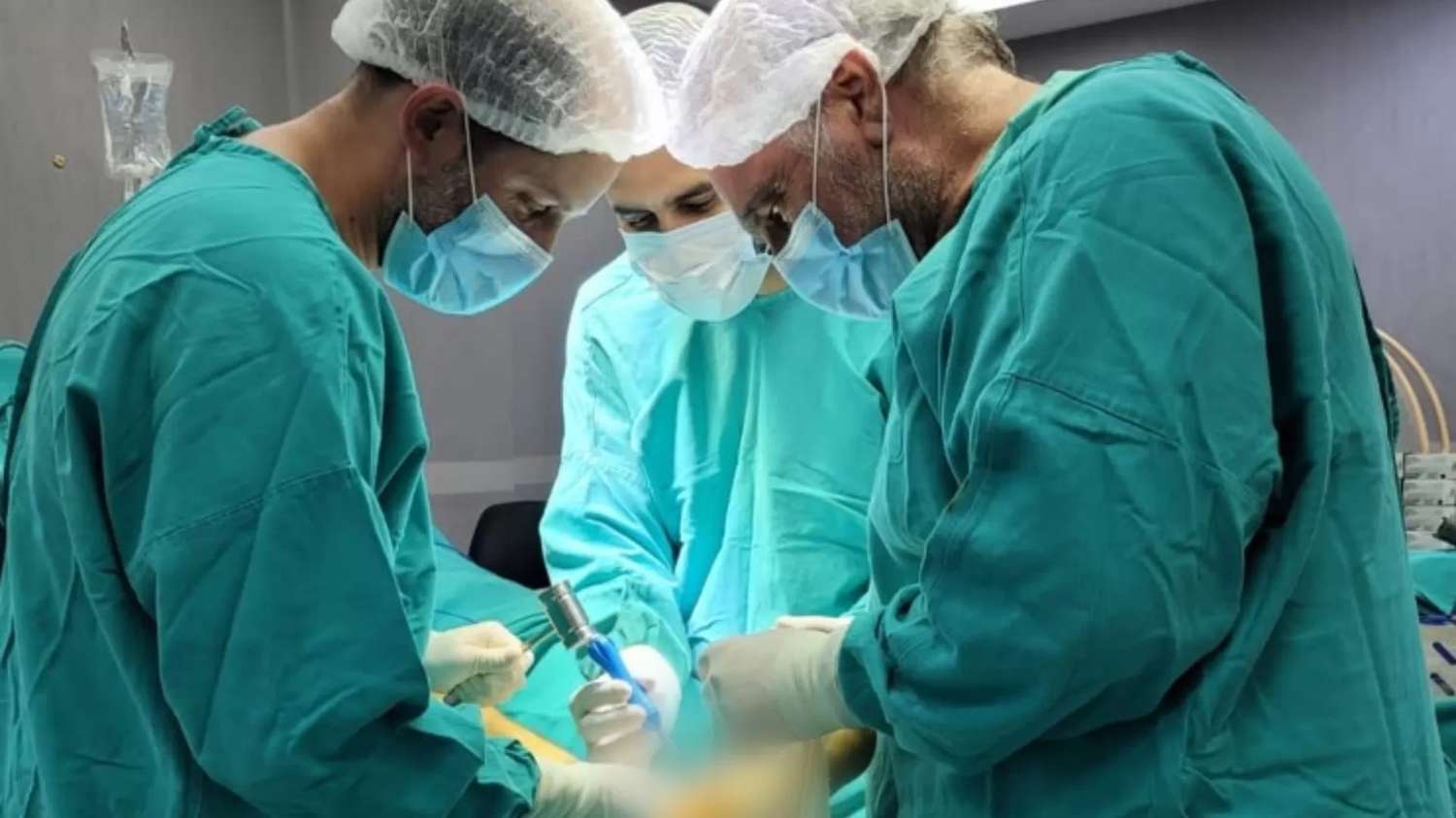 Tres cirujanos cardiovasculares participaron de la intervención.