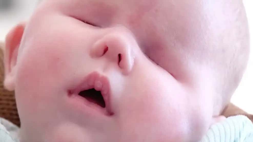 Una beba nacida sin ojos conmueve a Estados Unidos