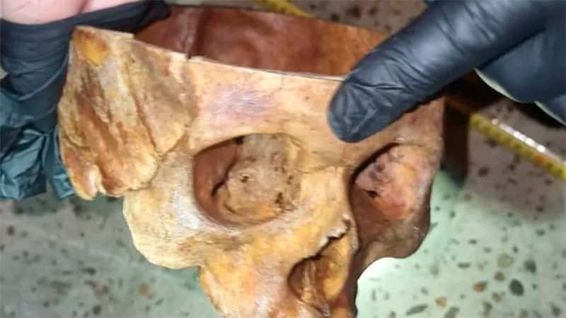 Una familia entrerriana encontró un cráneo humano en la vereda de su casa