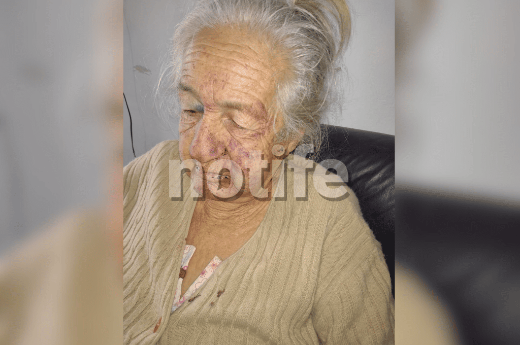 Santa Fe: una abuela fue brutalmente golpeada y maniatada durante un violento robo en su casa