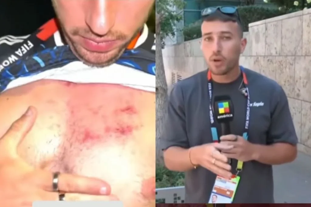 Martín Salwe fue agredido cuando intentó entrevistar a Tini Stoessel tras el partido de Argentina contra Suiza